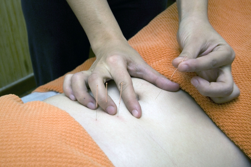 osteopathe-CAVALAIRE SUR MER-min_acupuncture-4175625